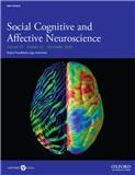 Social Cognitive and Affective Neuroscience《社会认知和情感神经科学》
