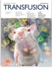 Transfusion《输血》