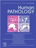 HUMAN PATHOLOGY《人体病理学》