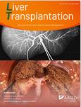 Liver Transplantation《肝脏移植》