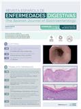 Revista Española de Enfermedades Digestivas（或：Revista Espanola de Enfermedades Digestivas）《西班牙消化系统疾病杂志》
